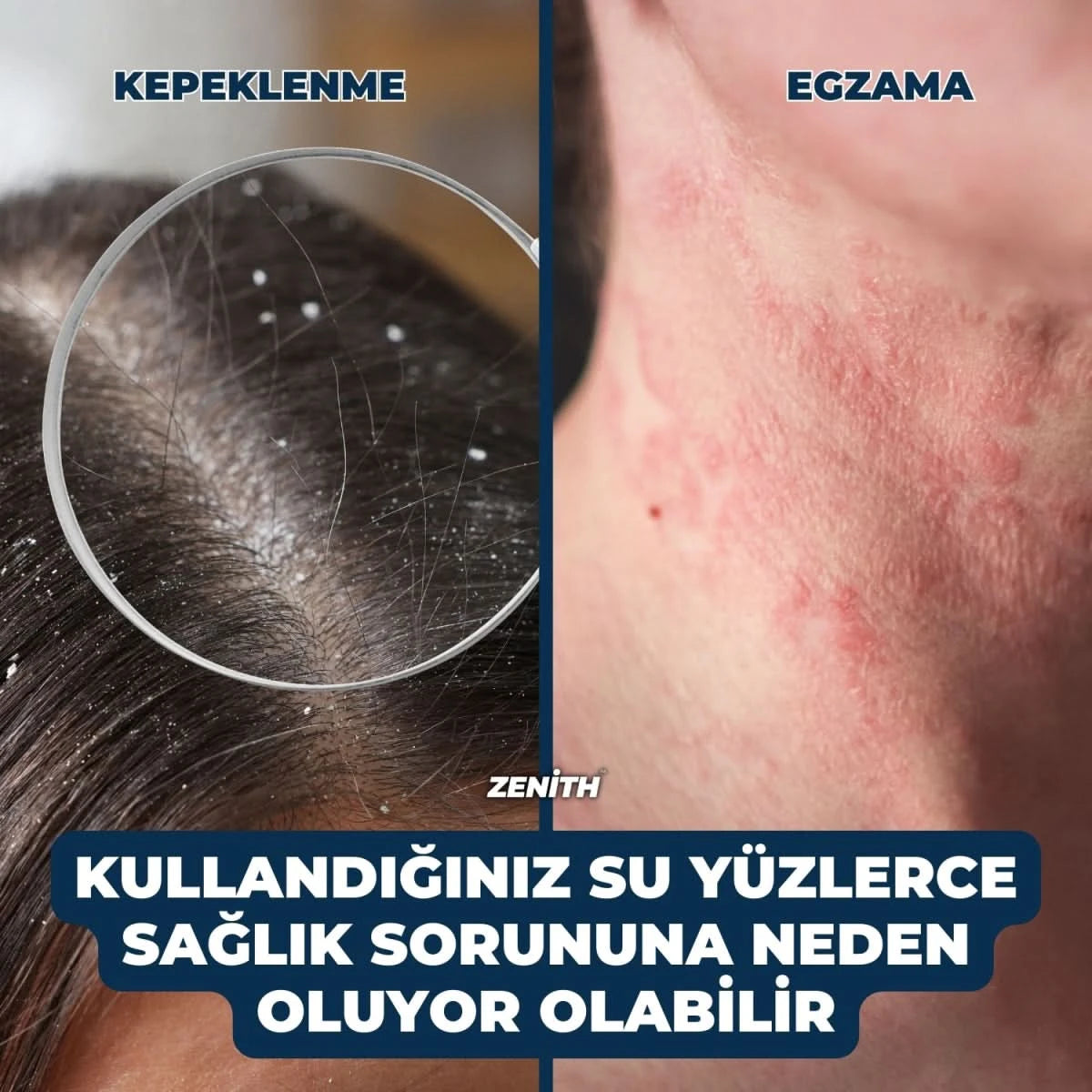 Zenith Filtreli Duş Başlığı - Zenith™